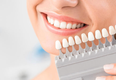 Transparente Aligner und Ernährung: Welche Lebensmittel Sie während der Behandlung vermeiden sollten