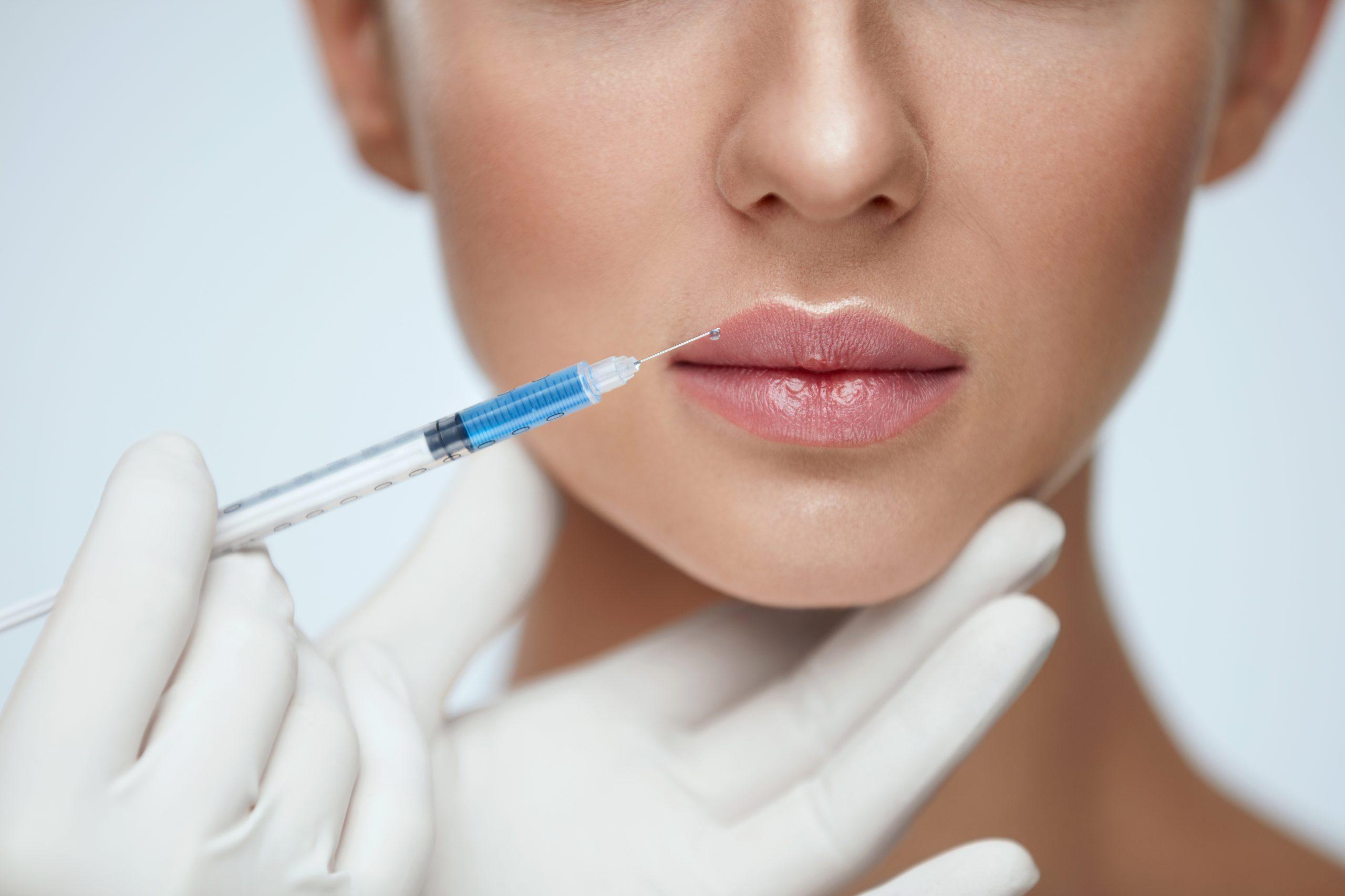 Lippen Aufspritzen Nürnberg: Ästhetik in Perfektion